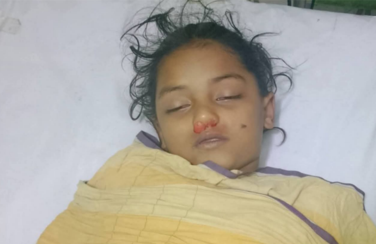 মহেশখালীর কালারমারছড়ায় সিএনজির ধাক্কায় শিশু নিহত