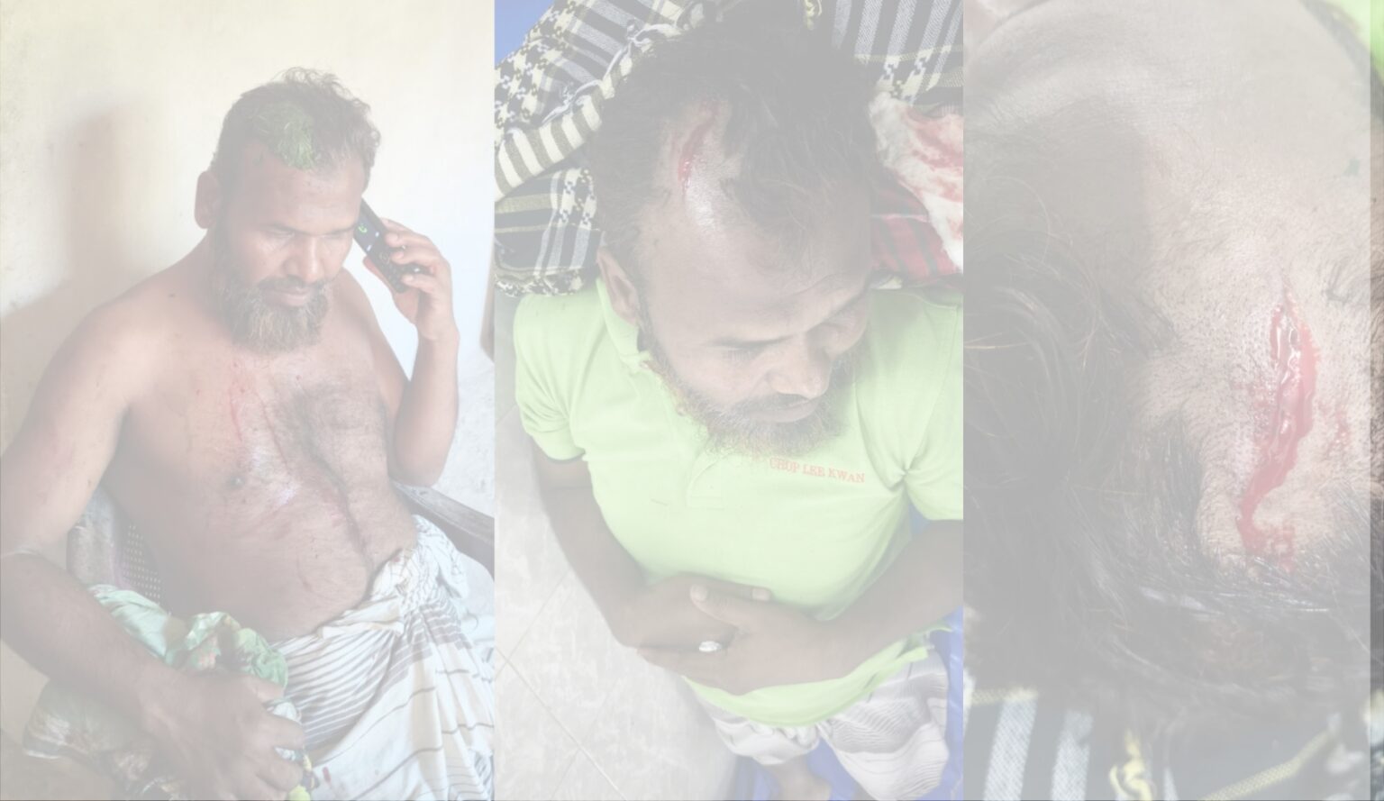 কালারমারছড়ায় সন্ত্রাসীদের হামলায় বিএনপি ও শ্রমিকদল নেতাসহ ৩ জন আহত